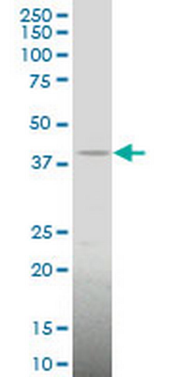 LHX4 Antibody in Western Blot (WB)