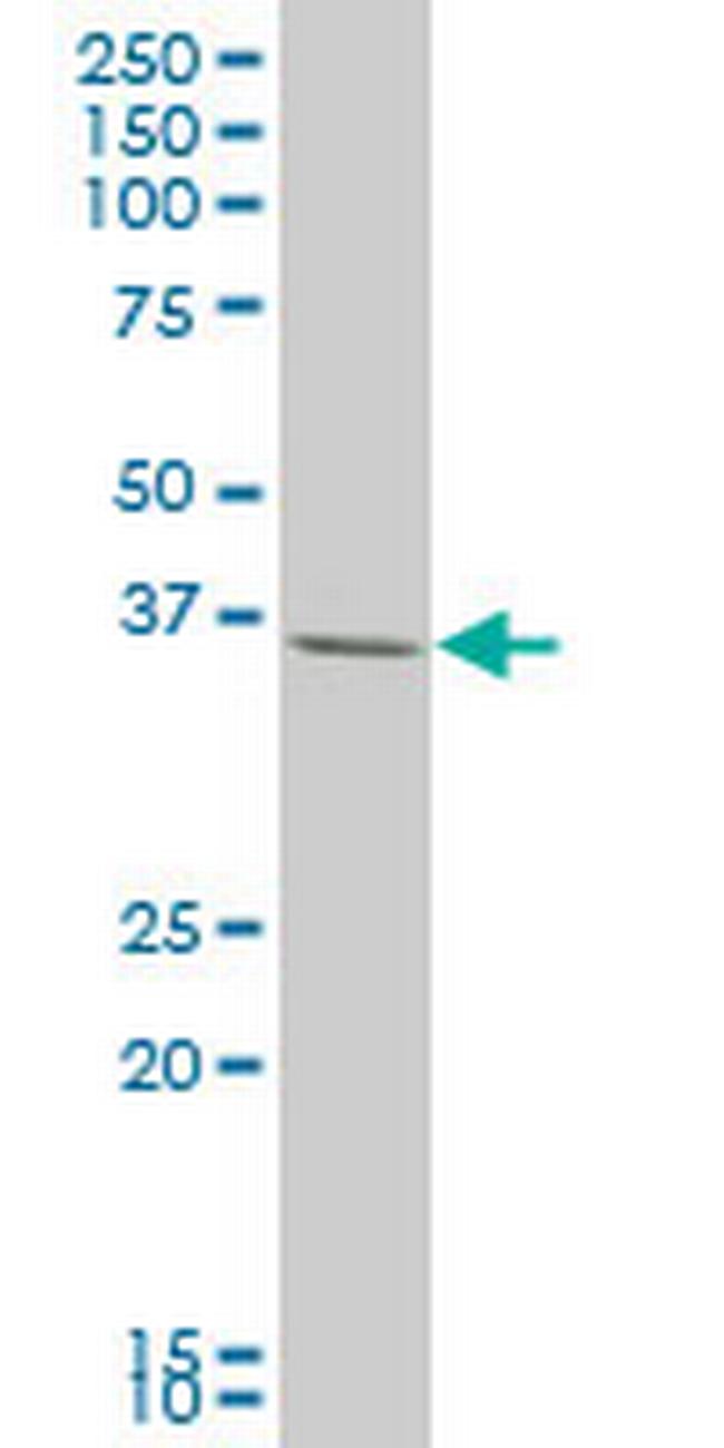 LHX4 Antibody in Western Blot (WB)