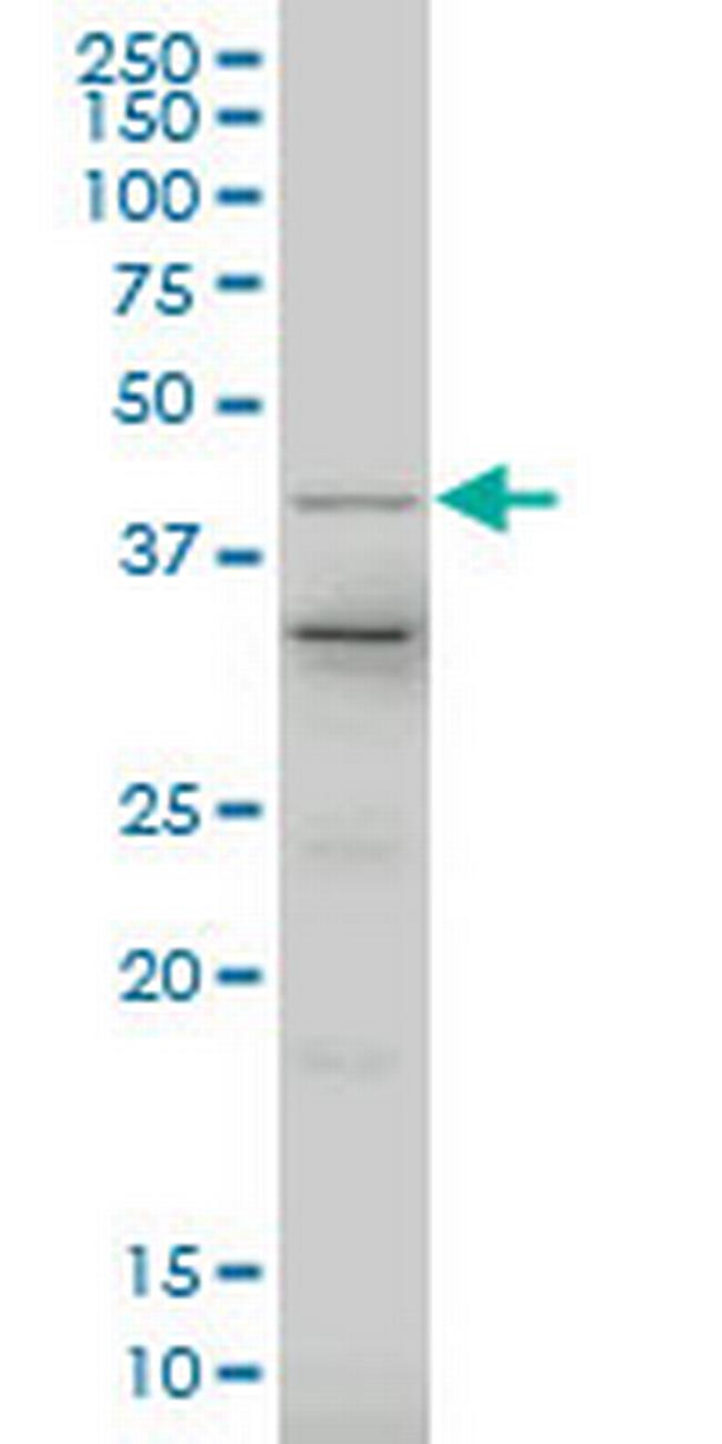 LHX4 Antibody in Western Blot (WB)