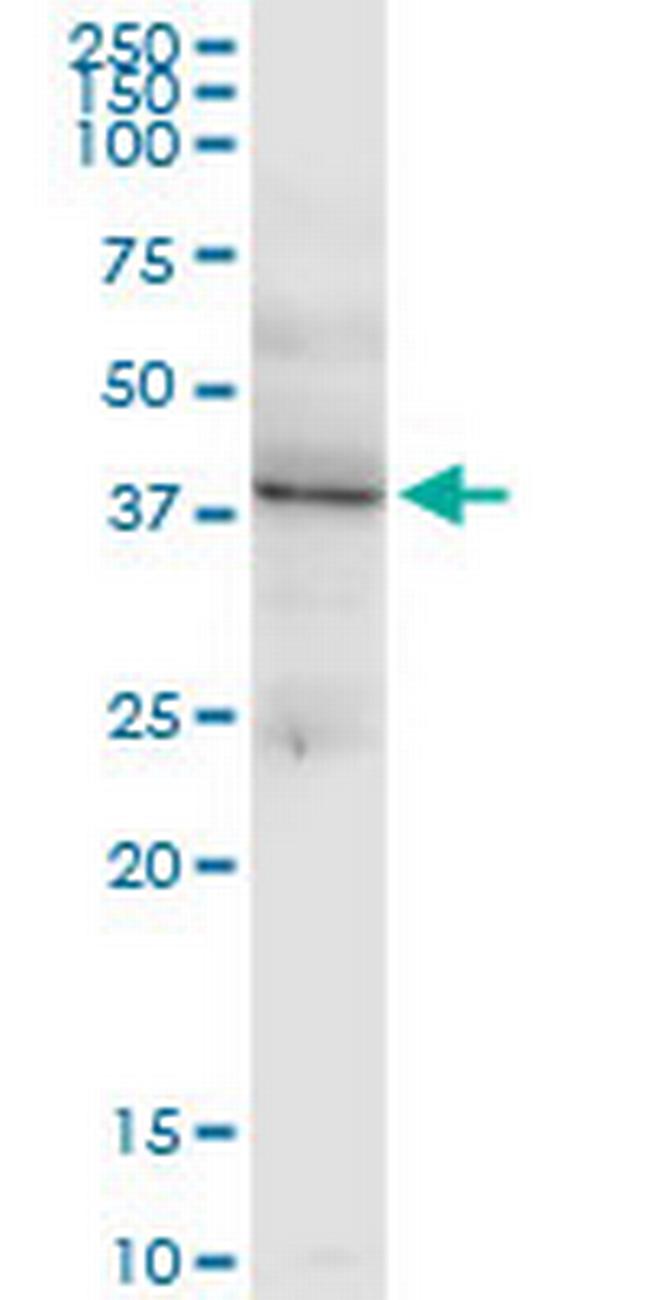 LHX4 Antibody in Western Blot (WB)