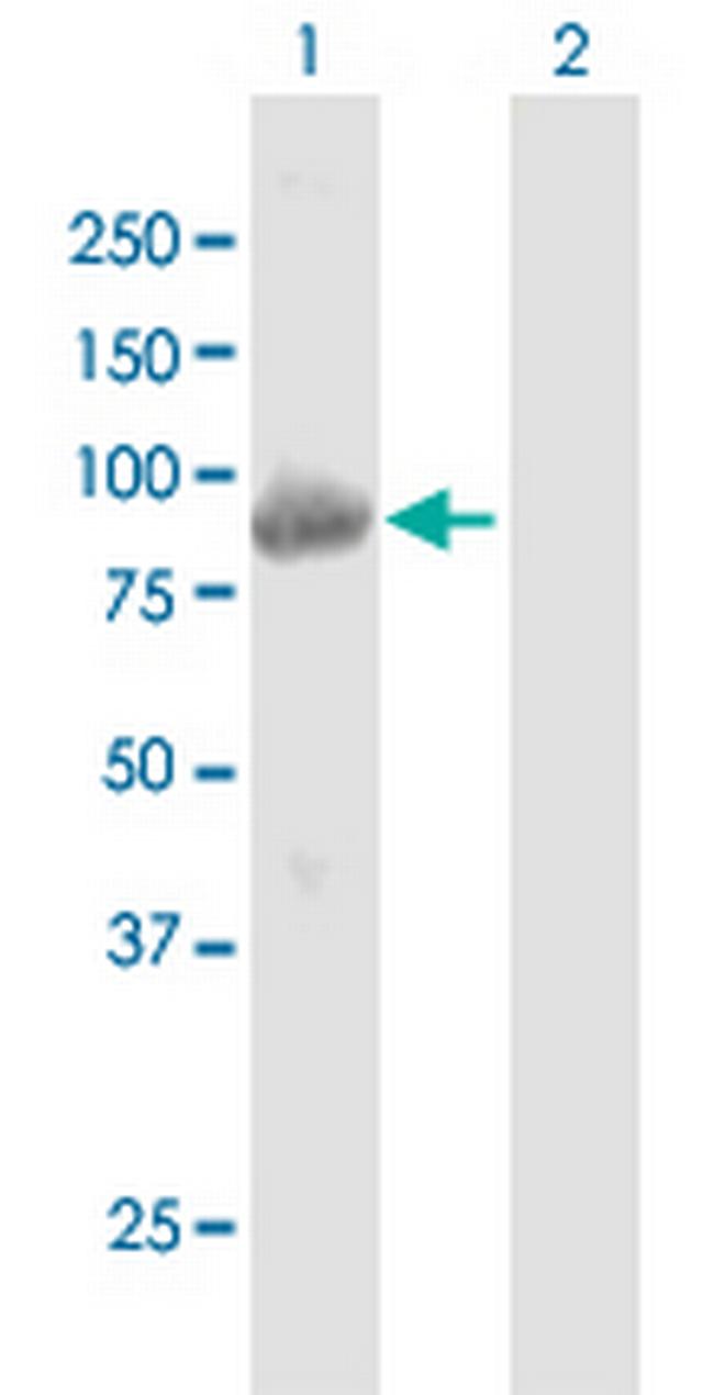 KBTBD6 Antibody in Western Blot (WB)