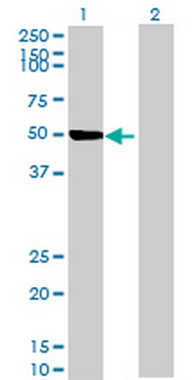 ZSWIM1 Antibody in Western Blot (WB)