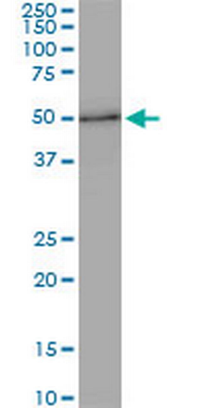 ZNF622 Antibody in Western Blot (WB)