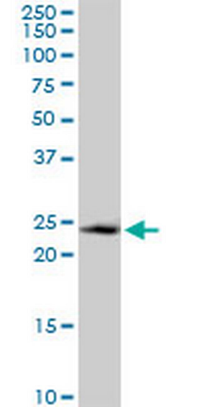 GADD45GIP1 Antibody in Western Blot (WB)