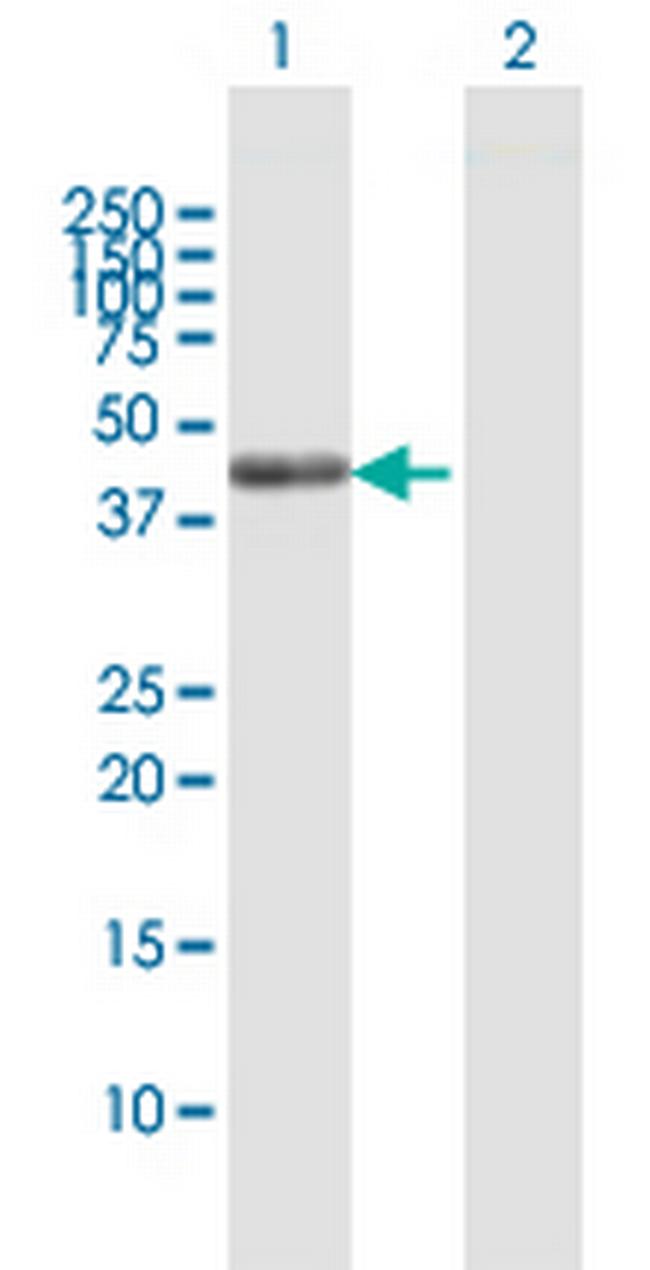 SCRN2 Antibody in Western Blot (WB)