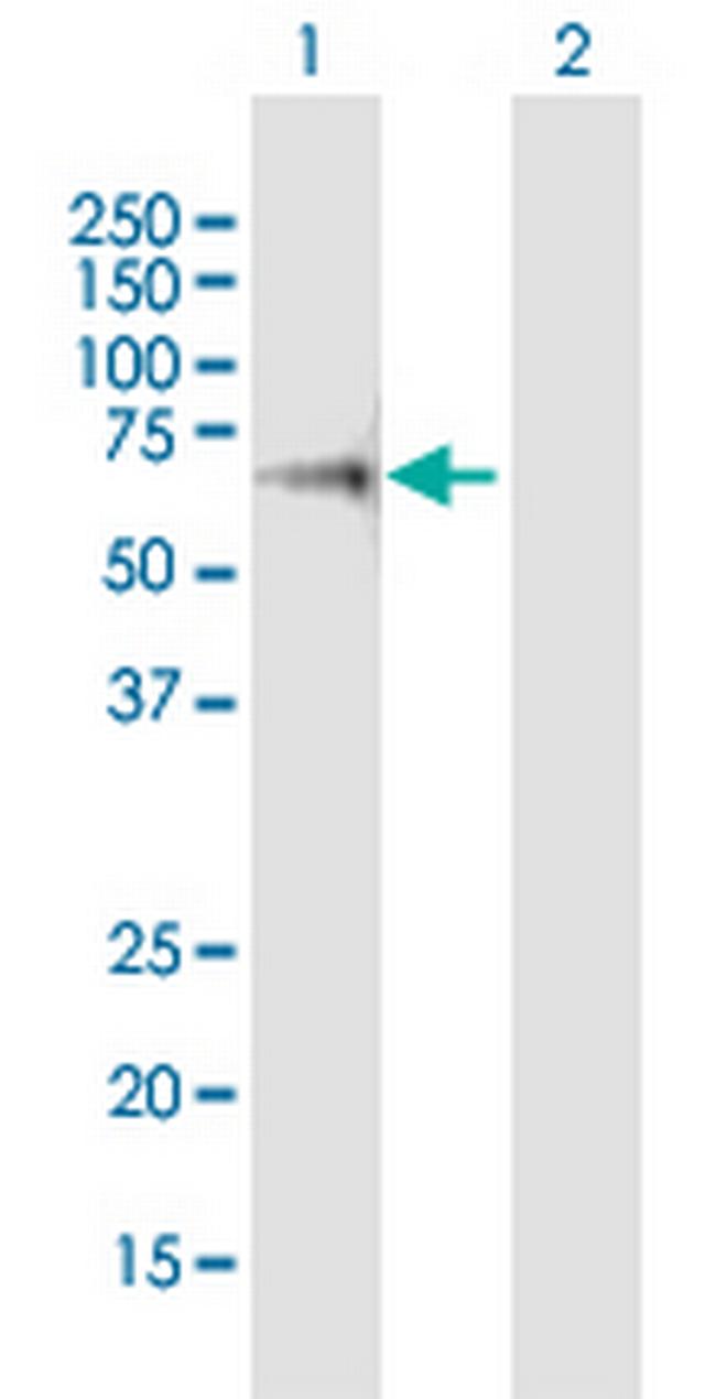 L3MBTL4 Antibody in Western Blot (WB)