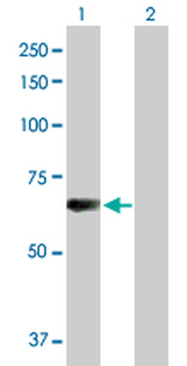 L3MBTL4 Antibody in Western Blot (WB)