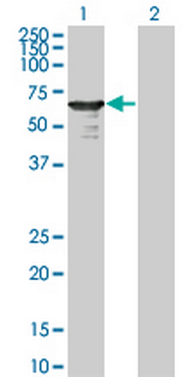 L3MBTL4 Antibody in Western Blot (WB)