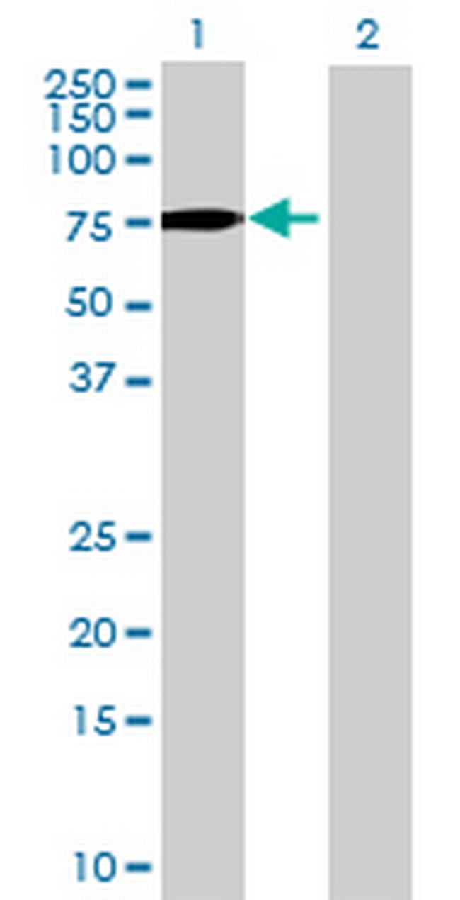 ACBD5 Antibody in Western Blot (WB)