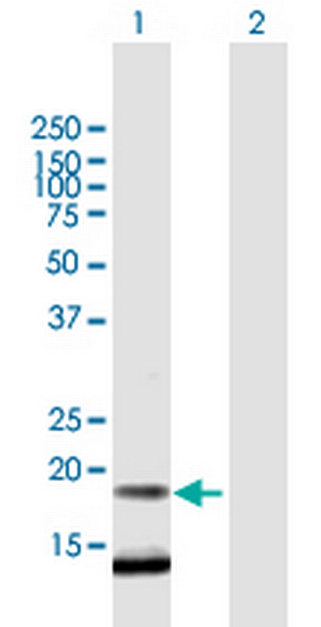 FLJ38663 Antibody in Western Blot (WB)