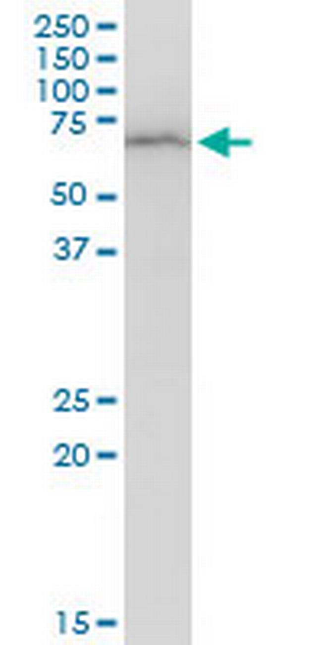 DEPDC7 Antibody in Western Blot (WB)