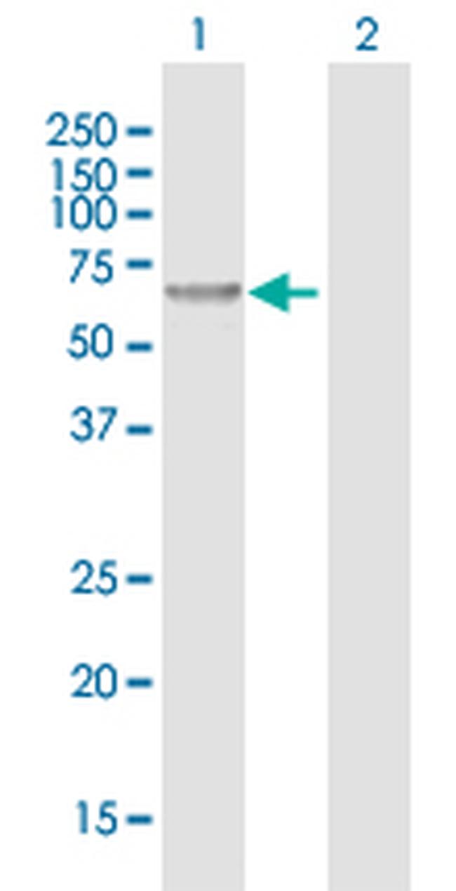 CHMP7 Antibody in Western Blot (WB)