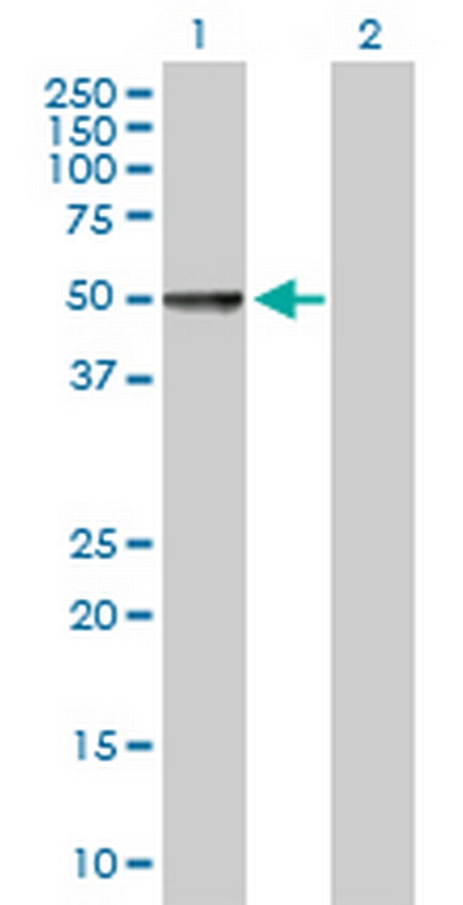 CHRDL1 Antibody in Western Blot (WB)