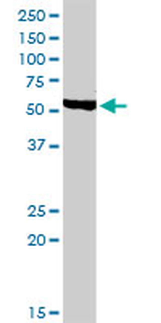 CHRDL1 Antibody in Western Blot (WB)