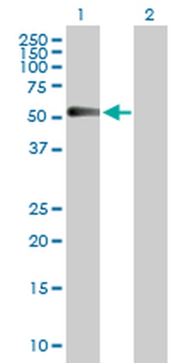 CHRDL1 Antibody in Western Blot (WB)