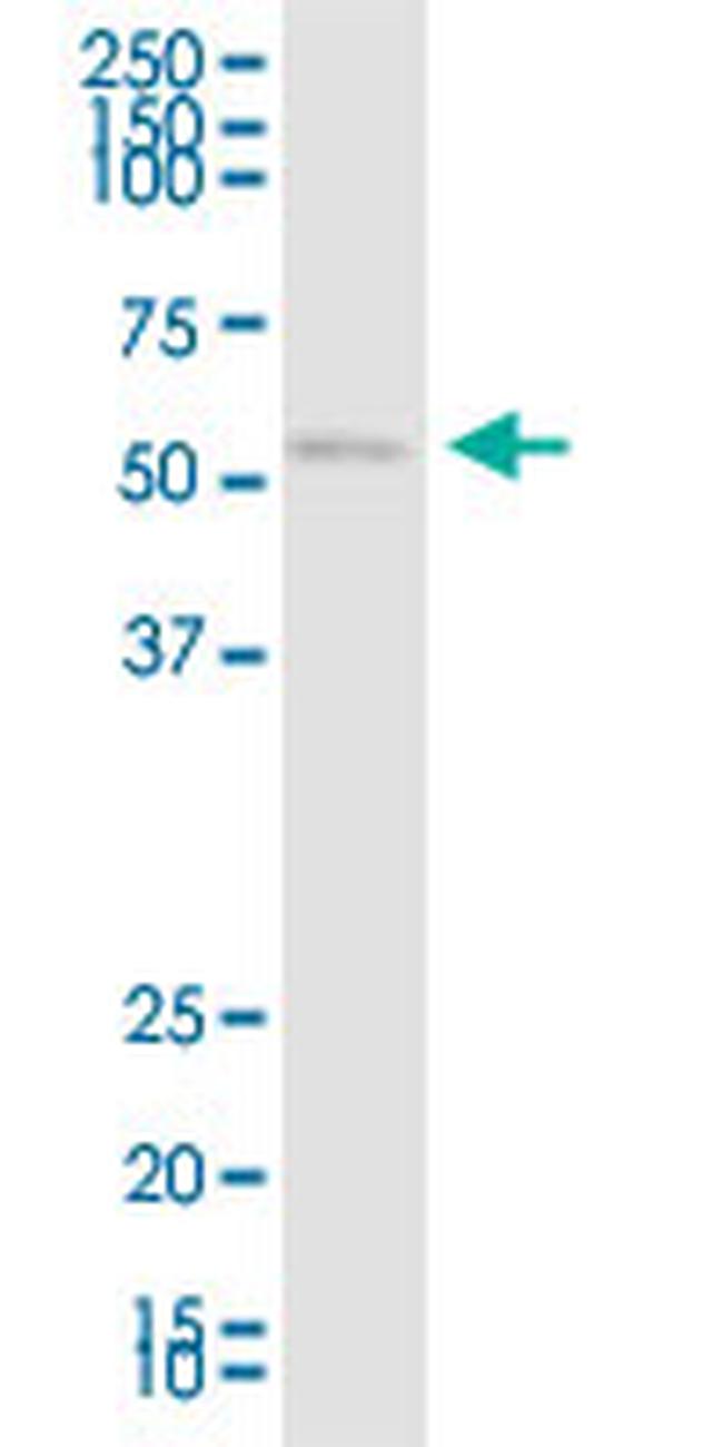 CHRDL1 Antibody in Western Blot (WB)