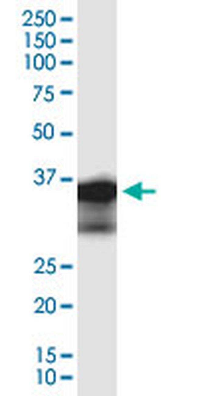 ZC3HAV1L Antibody in Western Blot (WB)