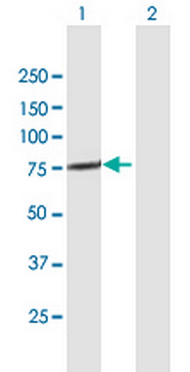 TTC30A Antibody in Western Blot (WB)