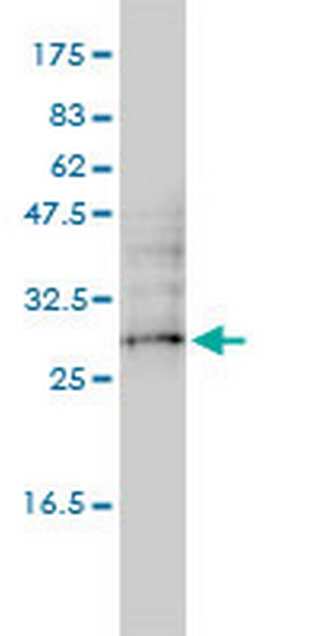 DC-UbP Antibody in Western Blot (WB)