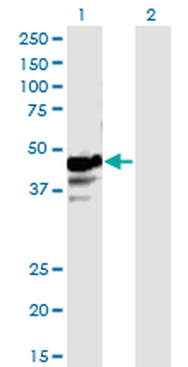 NAPRT1 Antibody in Western Blot (WB)