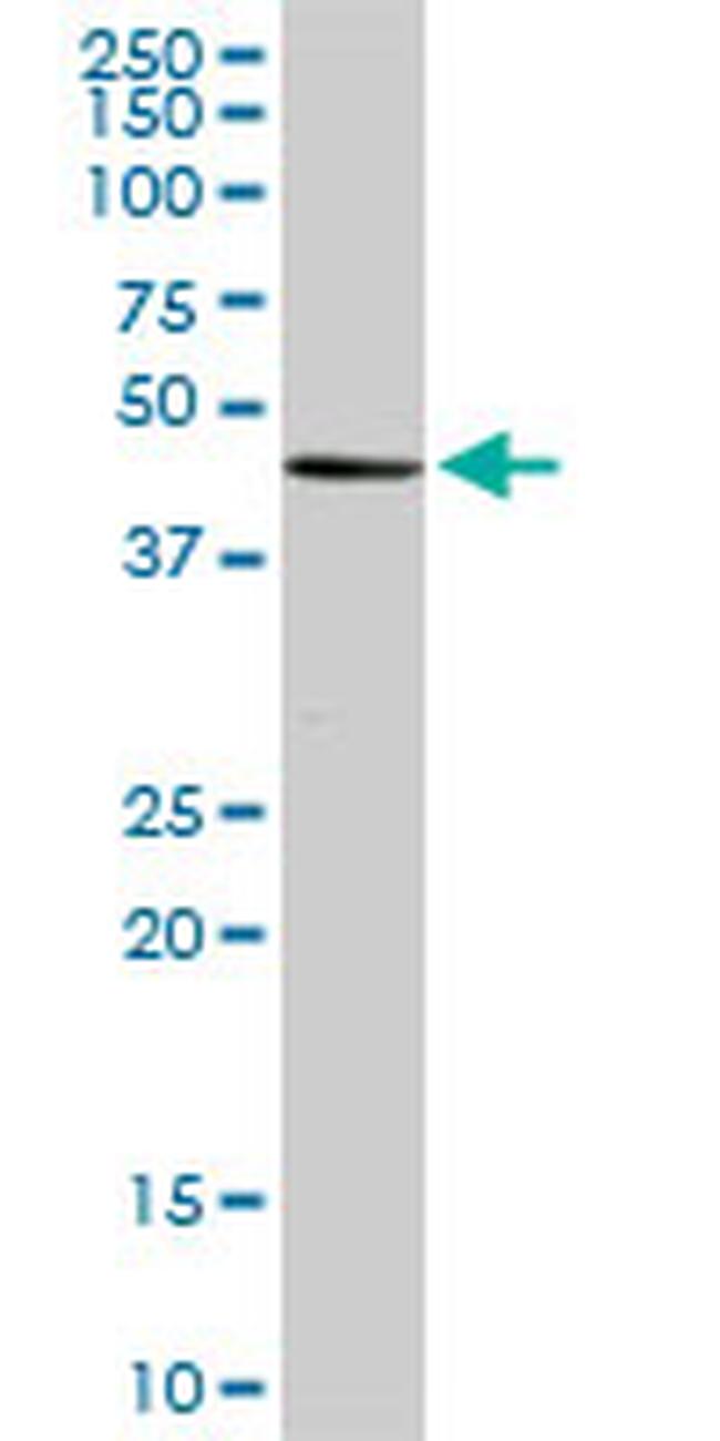 MGC21874 Antibody in Western Blot (WB)