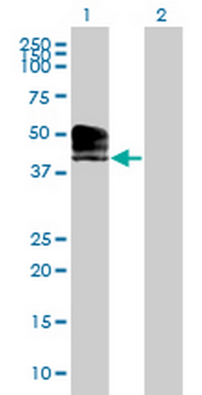 ACPT Antibody in Western Blot (WB)