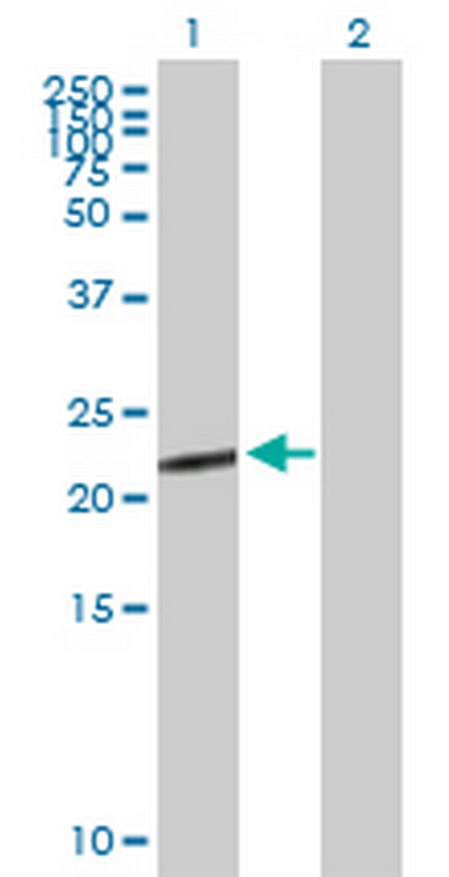 CGB5 Antibody in Western Blot (WB)