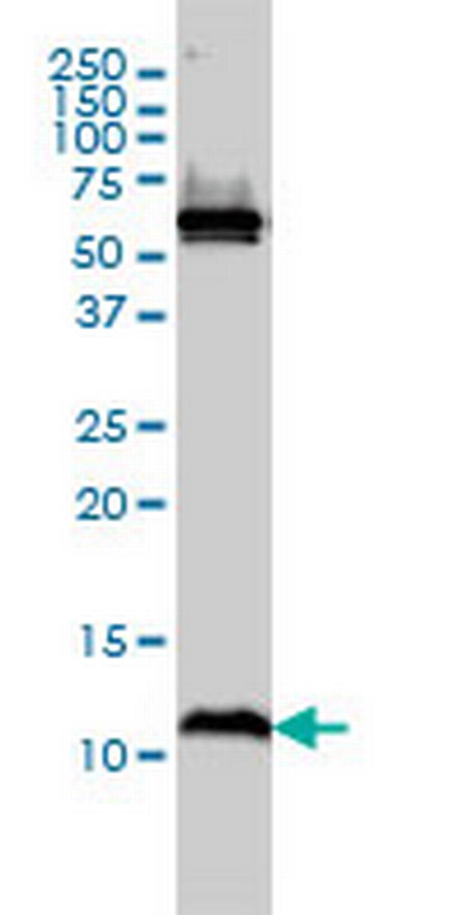 ATPIF1 Antibody in Western Blot (WB)