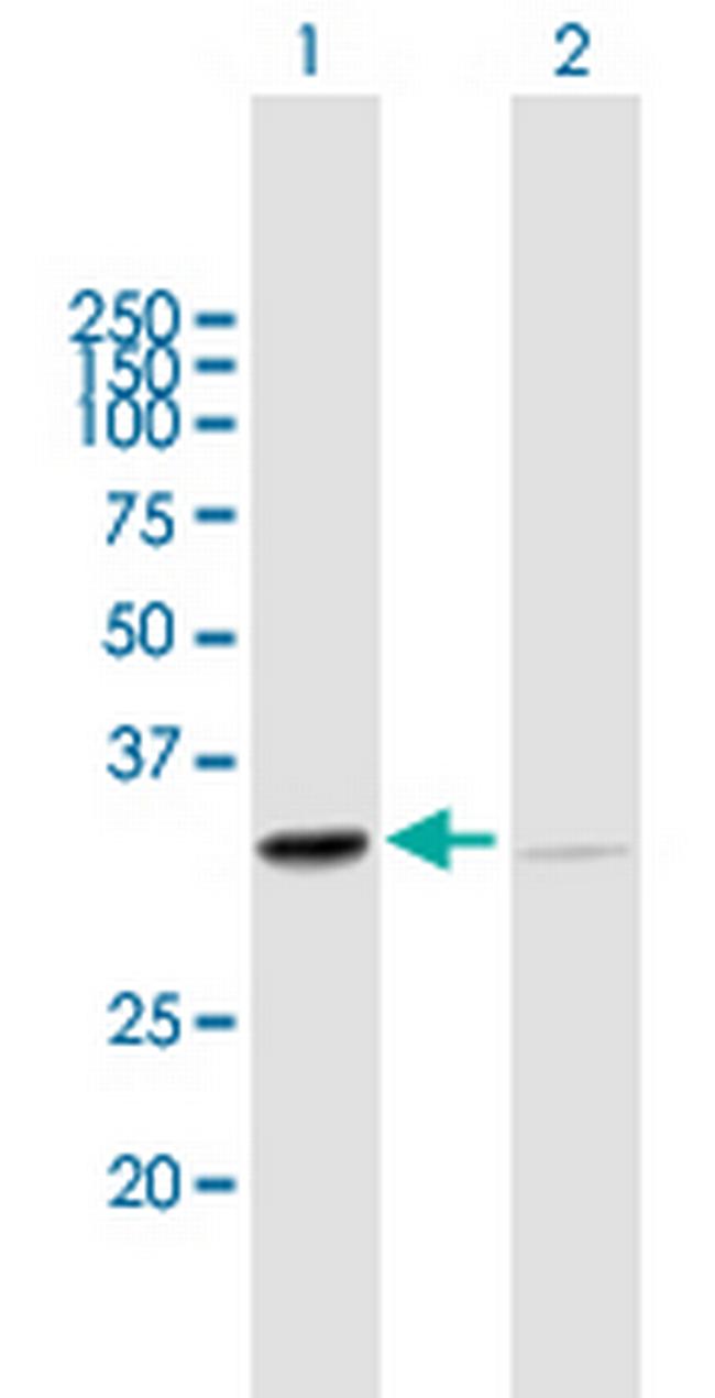 SFXN1 Antibody in Western Blot (WB)