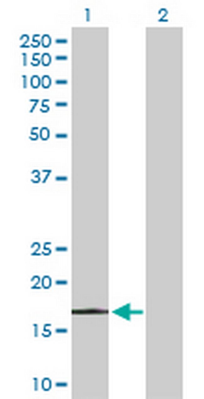 PPP1R14A Antibody in Western Blot (WB)