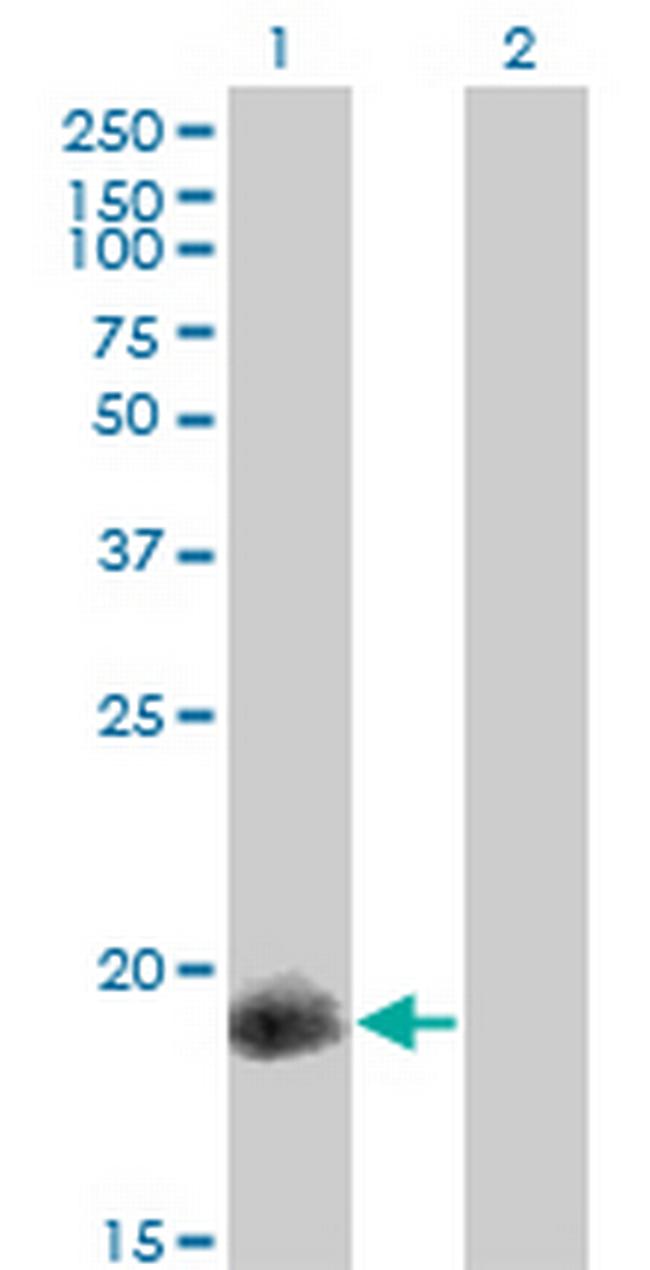 PPP1R14A Antibody in Western Blot (WB)