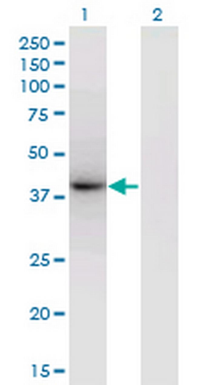 PRKCDBP Antibody in Western Blot (WB)