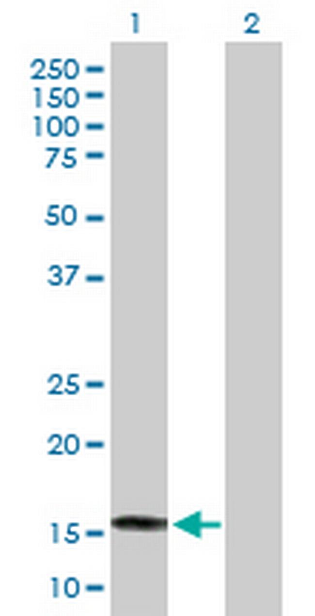 SAT2 Antibody in Western Blot (WB)