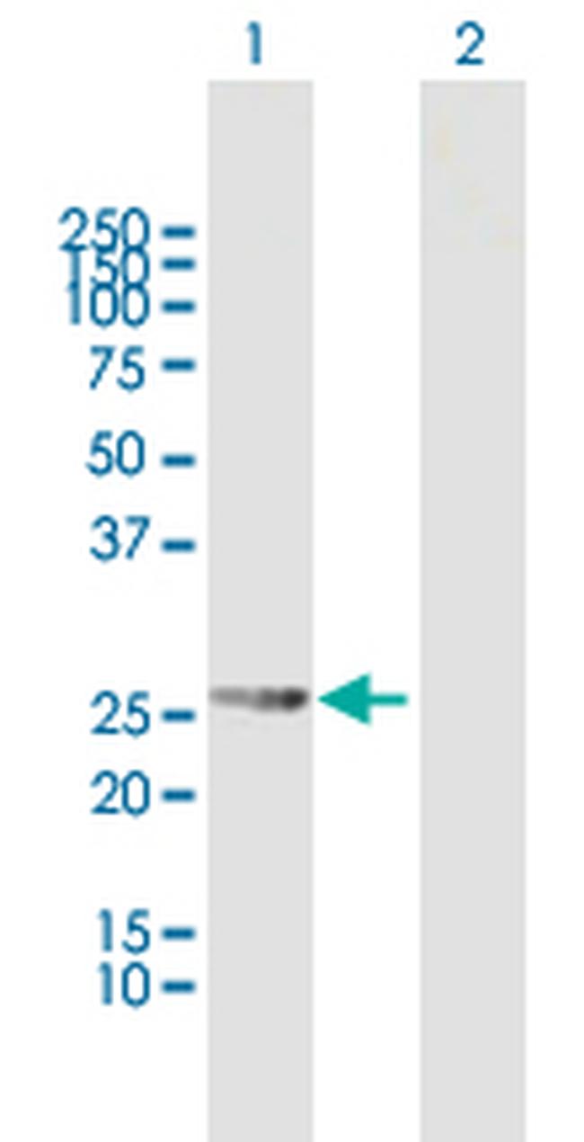 RDH13 Antibody in Western Blot (WB)