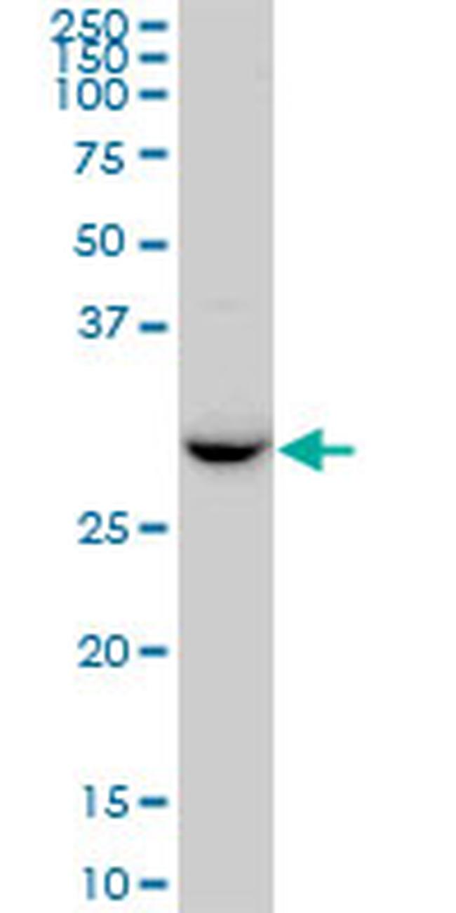 RDH13 Antibody in Western Blot (WB)