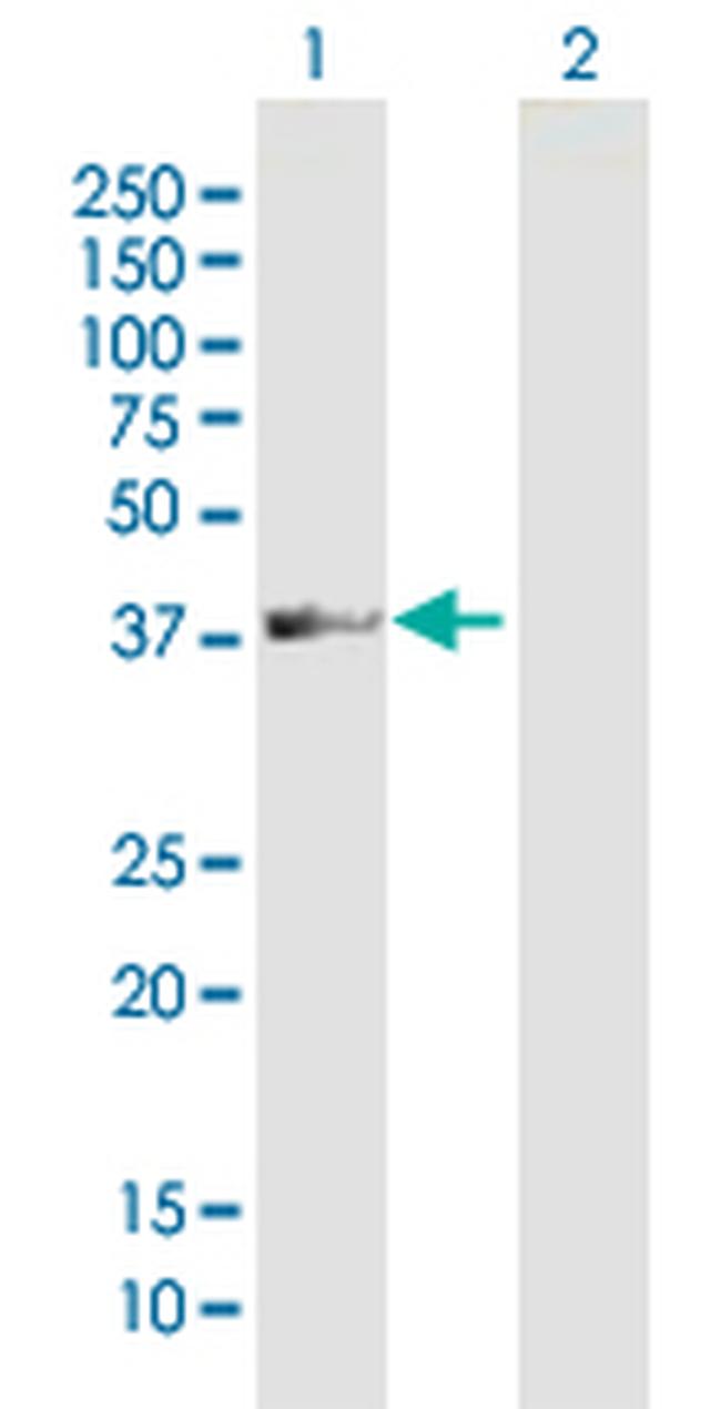 ADAT3 Antibody in Western Blot (WB)