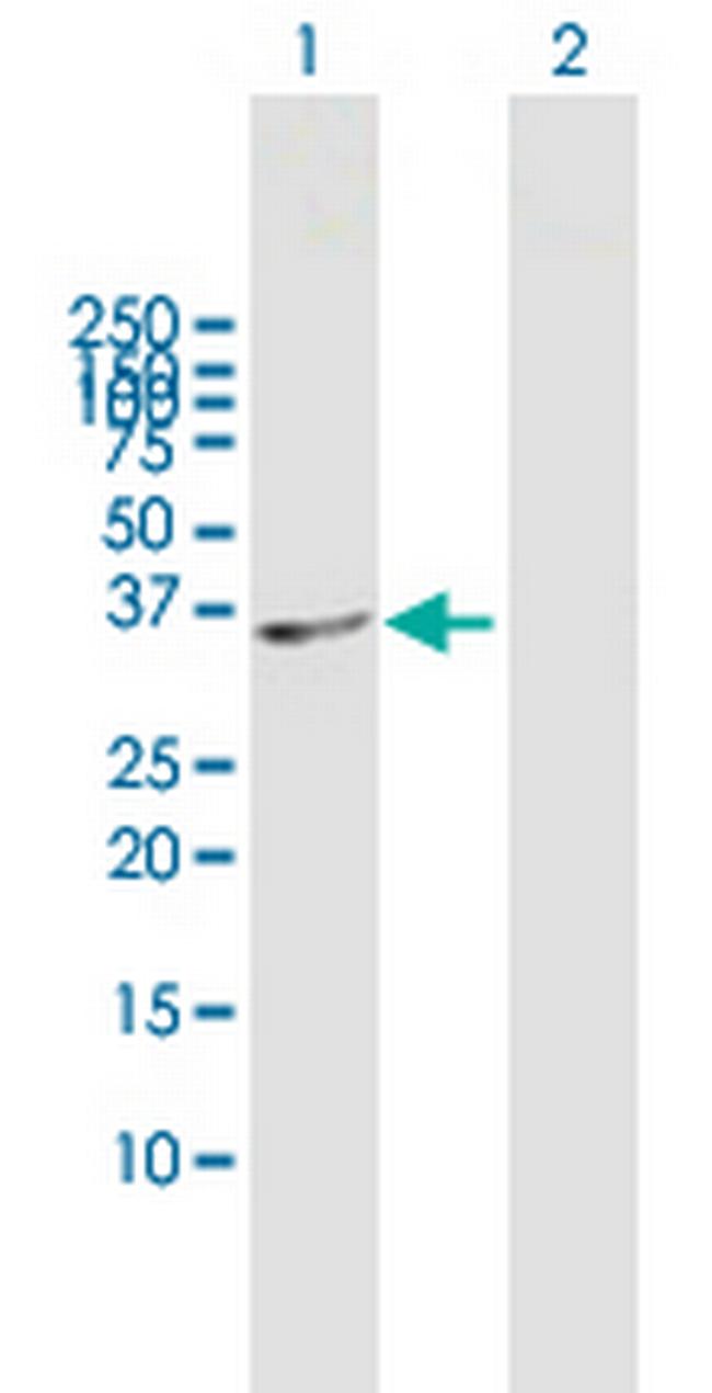 SDSL Antibody in Western Blot (WB)