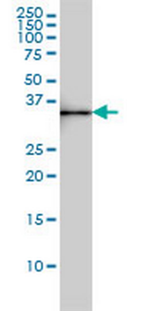 SDSL Antibody in Western Blot (WB)