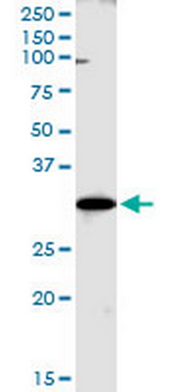 WBSCR22 Antibody in Western Blot (WB)