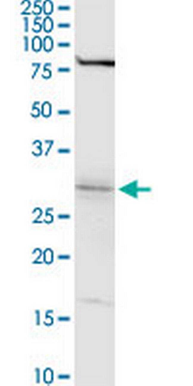 WBSCR22 Antibody in Western Blot (WB)