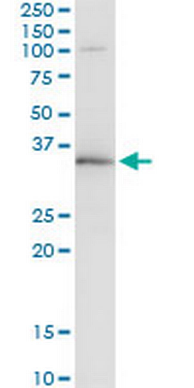 WBSCR22 Antibody in Immunoprecipitation (IP)