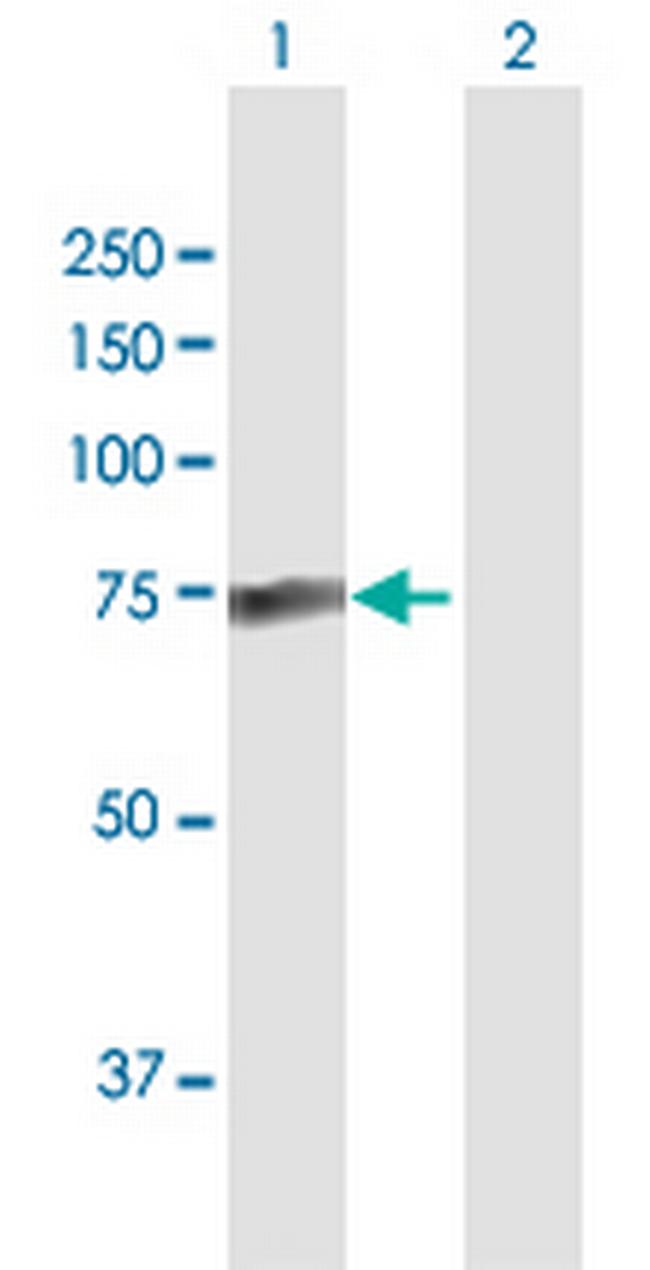 PALM2 Antibody in Western Blot (WB)