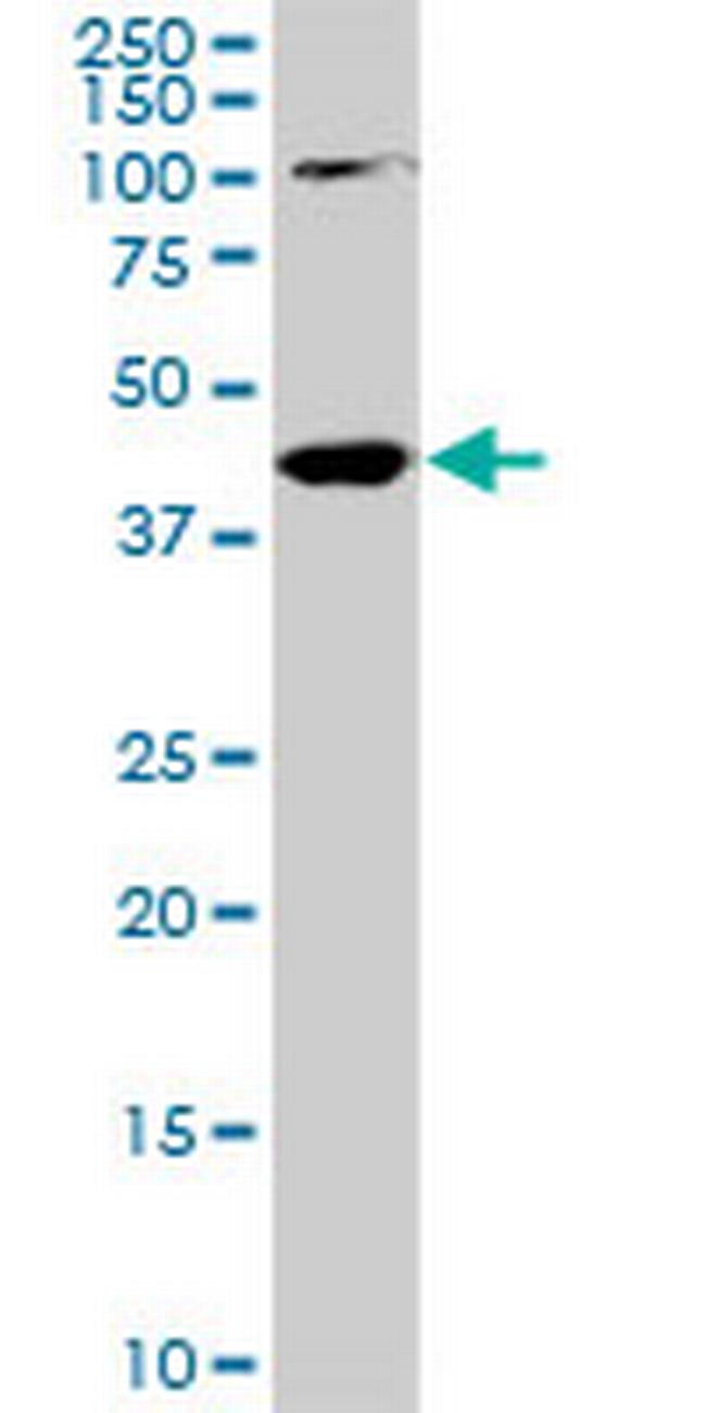 PALM2 Antibody in Western Blot (WB)