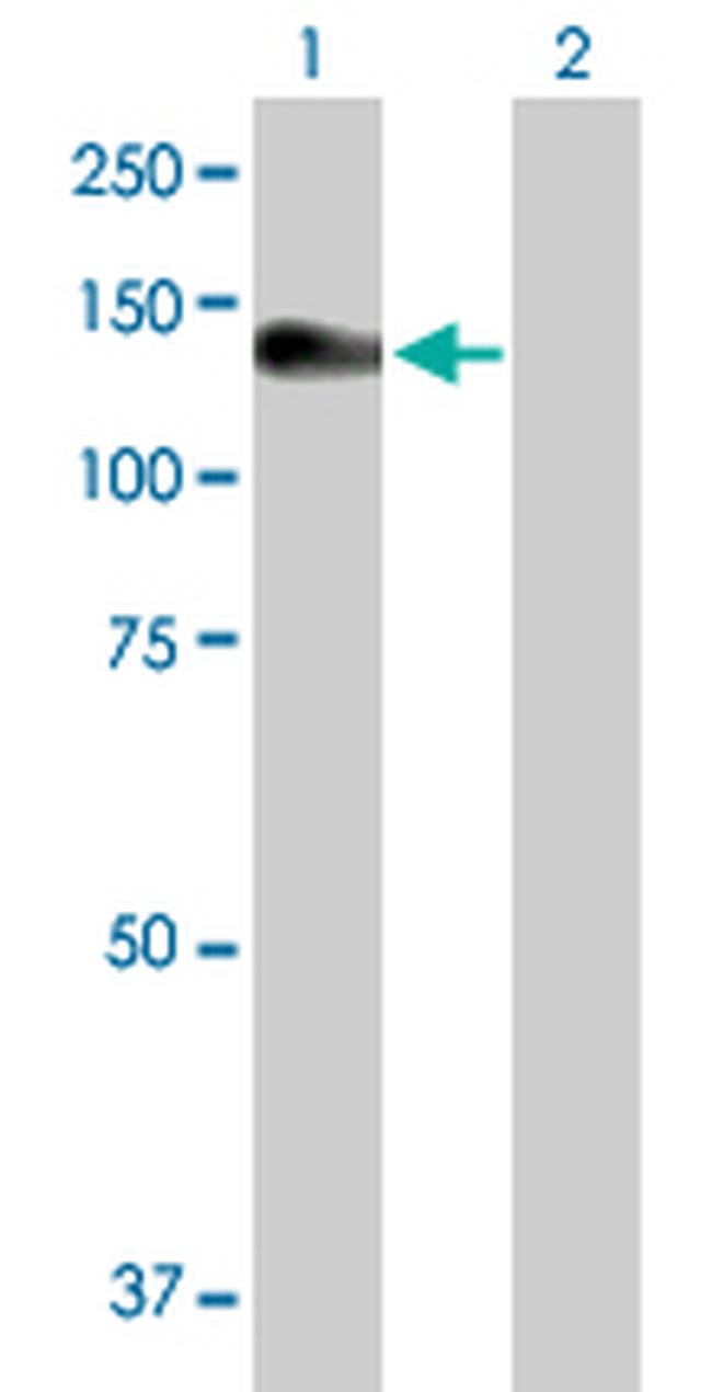 NLRP3 Antibody in Western Blot (WB)