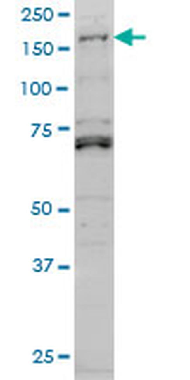 LMTK3 Antibody in Western Blot (WB)