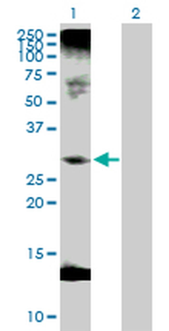 C1QTNF1 Antibody in Western Blot (WB)