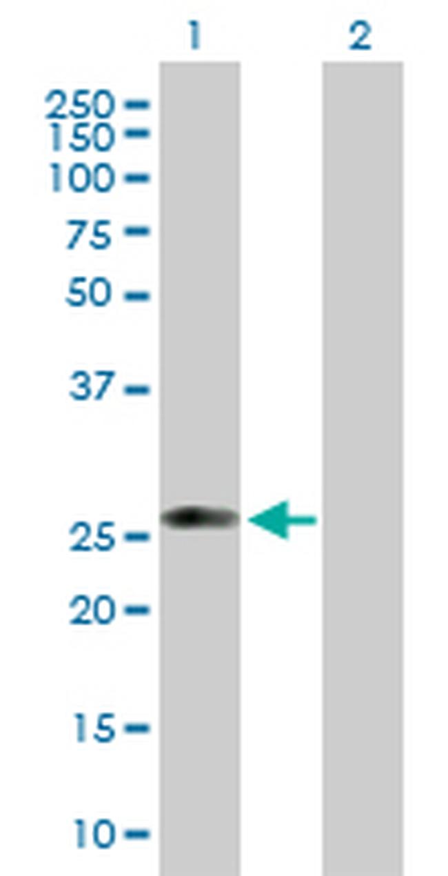 C1QTNF5 Antibody in Western Blot (WB)