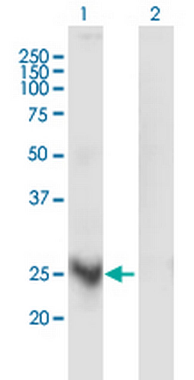 MARCH3 Antibody in Western Blot (WB)