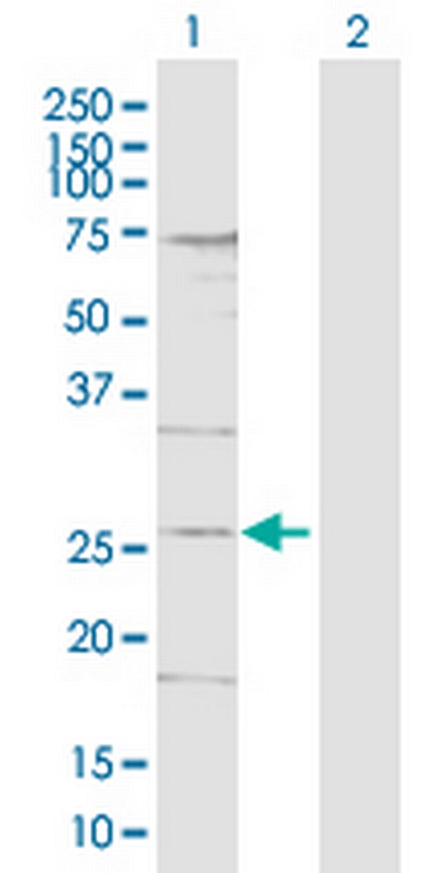 DDIT4L Antibody in Western Blot (WB)