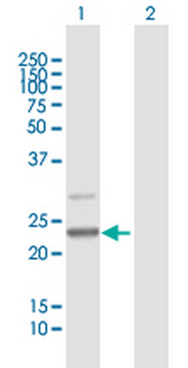 C7orf30 Antibody in Western Blot (WB)